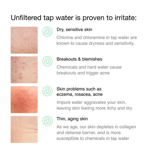 Filtered Showerhead