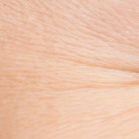 Thinning, aging skin